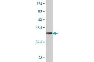 Western Blot detection against Immunogen (36. (DCP1A anticorps  (AA 186-285))