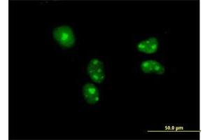 Immunofluorescence of purified MaxPab antibody to BYSL on HeLa cell.