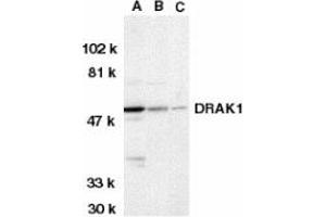 Image no. 1 for anti-serine/threonine Kinase 17a (STK17A) (AA 5-19) antibody (ABIN203102) (STK17A anticorps  (AA 5-19))