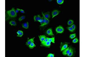 Immunofluorescent analysis of MCF-7 cells using ABIN7149171 at dilution of 1:100 and Alexa Fluor 488-congugated AffiniPure Goat Anti-Rabbit IgG(H+L)