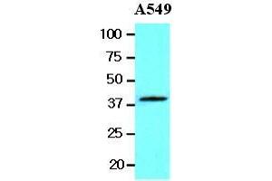 The lysates of A549 (20 ug) were resolved by SDS-PAGE, transferred to nitrocellulose membrane and probed with anti-human Wnt3a (1:1000).