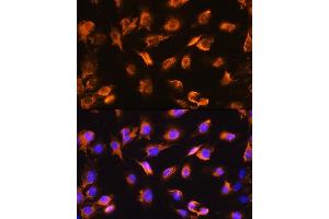 anti-Sarcoglycan, alpha (50kDa Dystrophin-Associated Glycoprotein) (SGCA) (AA 60-290) antibody