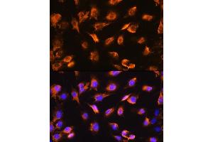 Immunofluorescence analysis of C6 cells using alpha Sarcoglycan (alpha Sarcoglycan (SGCA)) Rabbit pAb (ABIN1682687, ABIN5664644, ABIN5664646 and ABIN6220497) at dilution of 1:100. (SGCA anticorps  (AA 60-290))