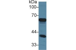 Detection of AFP in Mouse Cerebrum lysate using Polyclonal Antibody to Alpha-Fetoprotein (AFP) (alpha Fetoprotein anticorps  (AA 409-611))