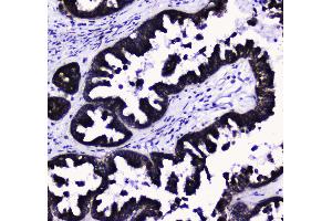 IHC analysis of COX IV using anti-COX IV antibody .