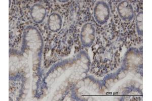 Immunoperoxidase of monoclonal antibody to USO1 on formalin-fixed paraffin-embedded human small Intestine. (USO1 anticorps  (AA 1-961))