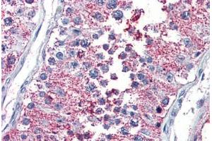 Testis, Human: Formalin-Fixed, Paraffin-Embedded (FFPE)