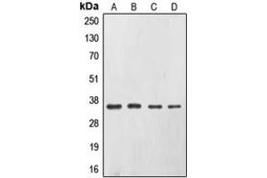 Western blot analysis of CD326 expression in A431 (A), SW480 (B), HepG2 (C), Caco2 (D) whole cell lysates. (EpCAM anticorps  (Center))