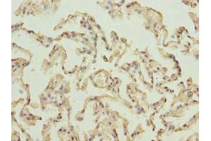 Immunohistochemistry of paraffin-embedded human lung tissue using ABIN7142727 at dilution of 1:100 (RPLP2 anticorps  (AA 1-115))