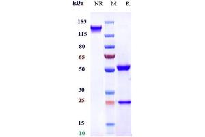 Anti-FGFR4 / CD334 Reference Antibody (U3-1784) on SDS-PAGE under reducing (R) condition. (Recombinant FGFR4 anticorps)