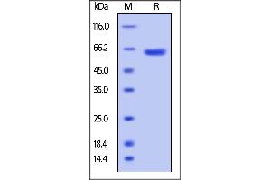 Biotinylated Human VSIG8, Fc,Avitag on  under reducing (R) condition.