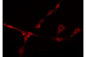 ABIN6274898 staining Hela cells by IF/ICC.