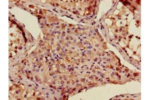 Immunohistochemistry of paraffin-embedded human testis tissue using ABIN7142874 at dilution of 1:100 (ADAMTS12 anticorps  (AA 26-229))