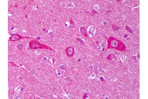 Anti-AHSA1 / AHA1 antibody IHC of human brain, cortex neurons.