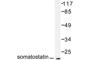 Image no. 2 for anti-Somatostatin (SST) antibody (ABIN271820) (Somatostatin anticorps)