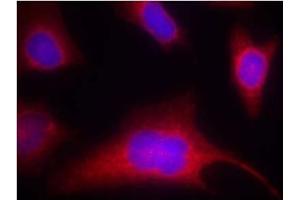 Image no. 2 for anti-Protein Kinase D1 (PRKD1) (pSer910) antibody (ABIN196784) (PKC mu anticorps  (pSer910))