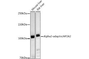 Western blot analysis of extracts of various cell lines, using Alph-adaptin/ antibody (ABIN6130980, ABIN6136955, ABIN6136957 and ABIN6221039) at 1:1000 dilution. (AP2A2 anticorps  (AA 590-939))
