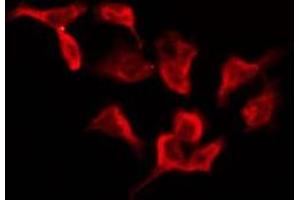 ABIN6276153 staining Hela by IF/ICC. (OR4D1 anticorps  (C-Term))