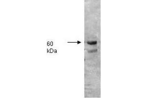 Image no. 2 for anti-Intestinal Alkaline Phosphatase (ALPI) antibody (ABIN303053) (Intestinal Alkaline Phosphatase anticorps)