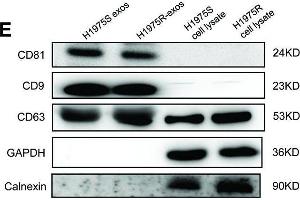 Establishment of osimertinib-resistant H1975 cell lines. (CD63 anticorps)