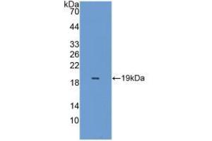 Western blot analysis of the recombinant protein. (Peroxiredoxin 5 anticorps  (AA 49-210))