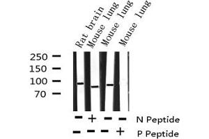 Western blot analysis of Phospho-p95/NBS1 (Ser343) expression in various lysates