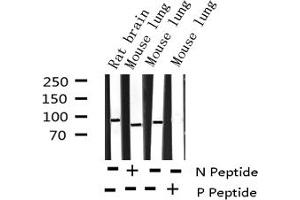 Western blot analysis of Phospho-p95/NBS1 (Ser343) expression in various lysates (Nibrin anticorps  (pSer343))