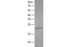 Western Blotting (WB) image for B-Cell CLL/lymphoma 7C (BCL7C) (AA 1-217) protein (His-IF2DI Tag) (ABIN7121964)