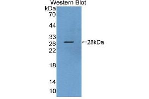 Western blot analysis of the recombinant protein. (KPNA3 anticorps  (AA 3-220))