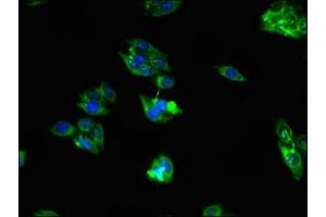 Immunofluorescent analysis of HepG2 cells using ABIN7167318 at dilution of 1:100 and Alexa Fluor 488-congugated AffiniPure Goat Anti-Rabbit IgG(H+L) (RAB39B anticorps  (AA 1-213))