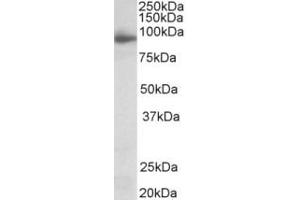 Western Blotting (WB) image for anti-Neuroligin 4 (NLGN4) (Internal Region) antibody (ABIN2465126) (Neuroligin 4 anticorps  (Internal Region))
