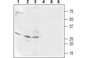Western blot analysis of  Human ARPE-19 retinal epithelium (lanes 1 and 4), mouse heart (lanes 2 and 5), and rat heart (lanes 3 and 6) lysates: - 1-3. (CABP2 anticorps  (Intracellular, N-Term))