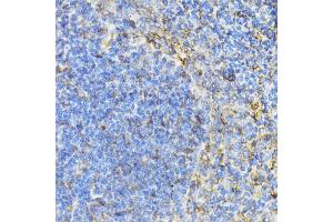 Immunohistochemistry of paraffin-embedded mouse spleen using STAT4 antibody (ABIN5974204) at dilution of 1/100 (40x lens). (STAT4 anticorps)