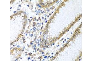 Immunohistochemistry of paraffin-embedded Human stomach using EIF4E Polyclonal Antibody at dilution of 1:100 (40x lens). (EIF4E anticorps)