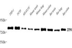 Western blot analysis of ZFP90 ABIN7076275),at dilution of 1: 2000,Lane 1: THP-1 cell lysate,Lane 2: T47D cell lysate,Lane 3: SH-SY5Y cell lysate,Lane 4: Mouse testis tissue lysate,Lane 5: Mouse lung tissue lysate,Lane 6: Mouse colon tissue lysate,Lane 7: Rat testis tissue lysate,Lane 8: Rat lung tissue lysate,Lane 9: Rat colon tissue lysate (ZNF90 anticorps)
