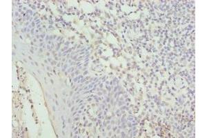 Immunohistochemistry of paraffin-embedded human tonsil tissue using ABIN7149090 at dilution of 1:100 (CYBC1 (AA 43-187) anticorps)