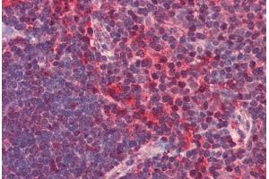 Human Thymus (formalin-fixed, paraffin-embedded) stained with CXCR6 antibody ABIN351436 at 2. (CXCR6 anticorps  (N-Term))