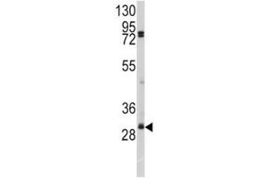 Western blot analysis of SLUG antibody and A2058 lysate. (SLUG anticorps  (AA 1-30))