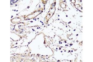 Immunohistochemistry of paraffin-embedded Human colon using VEGF Monoclonal Antibody at dilution of 1:150 (40x lens). (VEGF anticorps)