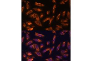 Immunofluorescence analysis of U-2 OS cells using CSF2 antibody (ABIN6130426, ABIN6139094, ABIN6139095 and ABIN6221725) at dilution of 1:100.