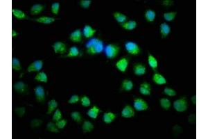 Immunofluorescence staining of Hela cells with ABIN7146984 at 1:166, counter-stained with DAPI.