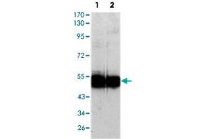Western blot analysis using VCAM1 monoclonal antobody, clone 6G9  against HUVEC (1) and EC (2) cell lysate. (VCAM1 anticorps)