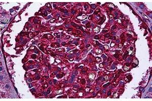 Human Kidney, Glomeruli: Formalin-Fixed, Paraffin-Embedded (FFPE) (Myosin 9 anticorps)