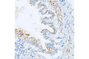 Immunohistochemistry of paraffin-embedded rat lung using IL3RA antibody (ABIN1680453, ABIN3018298, ABIN3018299, ABIN5664529 and ABIN6220429) at dilution of 1:100 (40x lens). (IL3RA anticorps  (AA 1-100))