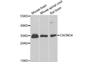 Western blot analysis of extracts of various cell lines, using CACNG4 antibody.