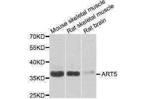 Western blot analysis of extracts of various cell lines, using ART5 antibody. (ART5 anticorps  (AA 23-200))