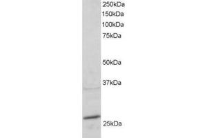 Image no. 1 for anti-RAB11A, Member RAS Oncogene Family (RAB11A) (C-Term) antibody (ABIN374252) (RAB11A anticorps  (C-Term))