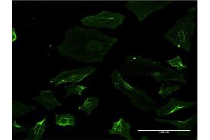 Immunofluorescence of monoclonal antibody to SPAST on HeLa cell. (Spastin anticorps  (AA 200-304))