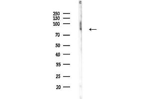 Western blot analysis of lysates from COLO205 cells(heat-shock,45 min treatment), using Choline Acetyltransferase Antibody at 1/1000 dilution.