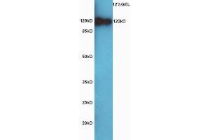 Lane 1: Huh7 probed with Rabbit Anti-CD44 Polyclonal Antibody, Unconjugated (ABIN669591) at 1:300 overnight at 4 °C. (CD44 anticorps  (AA 701-742))